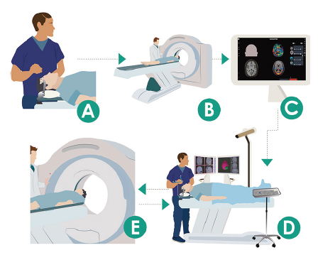 Neuronavegación