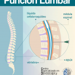 Punción Lumbar