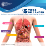 Principales tipos de Cáncer